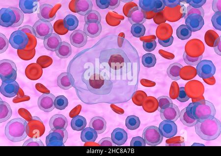 Figura di rappresentazione della cellula Reed-Sternberg in linfoma hodgkin vista frontale 3D Foto Stock