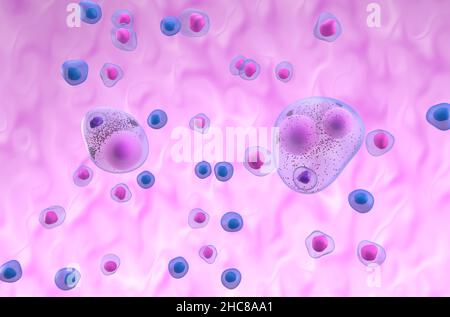 Corpi di Lewy nel morbo di parkinson (PD) o demenza (LBD) - illustrazione isometrica 3D Foto Stock