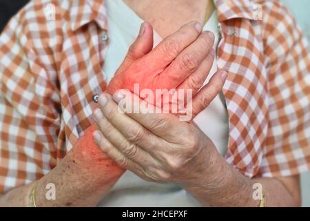 Dolore nelle mani della donna anziana del sud-est asiatico. Concetto di dolore della mano, artrite e problemi di tendine. Foto Stock
