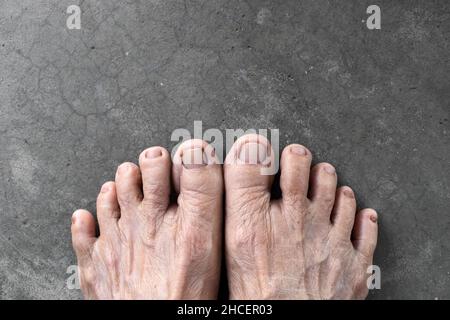 Piedi di donna anziana asiatica. Concetto di salute del piede e delle dita dei piedi, e pelle sottile. Isolato su sfondo concreto. Foto Stock