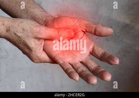 Aspetto palmo doloroso del vecchio asiatico. Concetto di sindrome compartimentale, cellulite e dolore ai muscoli delle mani. Foto Stock