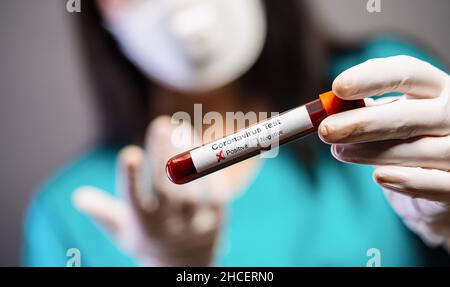 2019-nCoV Coronavirus. Campione di sangue positivo nella mano dei medici. Sindrome respiratoria. Coronavirus che si rompe Foto Stock