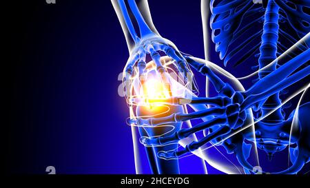 Anatomia del dolore articolare del ginocchio per concetto medico illustrazione 3D Foto Stock