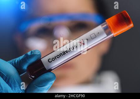 Campione di sangue di coronavirus 2019-nCoV. Interruzione del virus Corona. Corona Virus in Lab. Scienziato tenere una provetta con sangue Test acon il virus. Epizoozia Cor Foto Stock