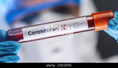Campione Di Sangue Infetto Di Coronavirus Covid-19 Nelle Mani Di Doctor Scientist. Epidemia E Epidemia Di Virus. Foto Stock