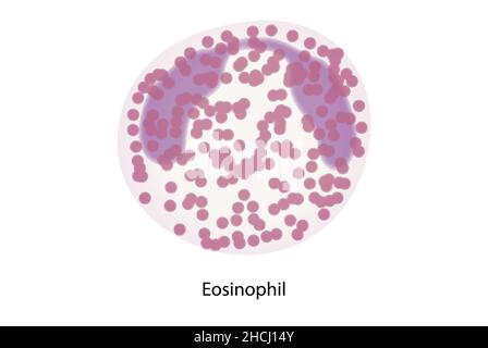 Eosinofili, globuli bianchi, cellule del sistema immunitario Foto Stock