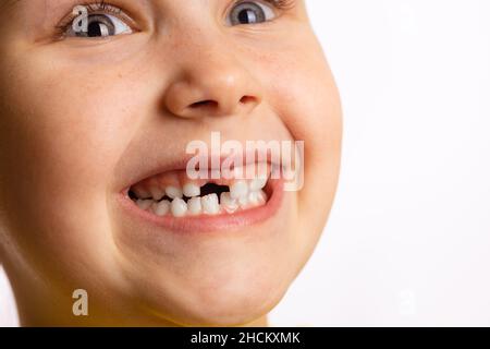 Primo piano di cute giovane ragazza faccia sorridente mostrando mancante latte anteriore dente guardando su sfondo bianco. I primi denti che cambiano andando al dentista fare Foto Stock