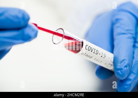 Macro closeup delle mani di un operatore medico in guanti blu che prelevano il campione di sangue COVID-19 del paziente dal contenitore della provetta utilizzando una pipetta, sierologia di laboratorio Foto Stock
