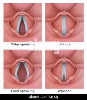 Ciclo vibratorio del cavo vocale (pieghe vocali) Foto Stock