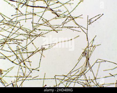 Nodularia alghe in vista microscopica, cianobatteria x10 fissante azoto, alghe blu-verdi, fioriture di alghe pesanti, cianotossine, alghe tossiche Foto Stock