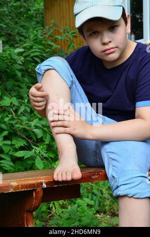 Closeup del ginocchio del bambino ferito dopo che è caduto giù sul pavimento, la gamba del ragazzo fa male. Livido, graffio dopo le passeggiate estive o gli sport. Unint anestetico Foto Stock