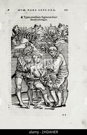 L'illustrazione del 16th secolo di chirurgia e interventi chirurgici nel Medioevo: Rimozione chirurgica di una freccia a croce sul campo di battaglia. Dal Foto Stock
