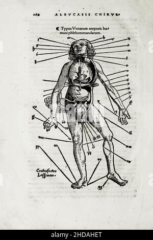 L'illustrazione di 16th secolo della chirurgia e delle operazioni chirurgiche nel Medioevo: Tipo delle vene del corpo umano. Dai libri medievali di o Foto Stock