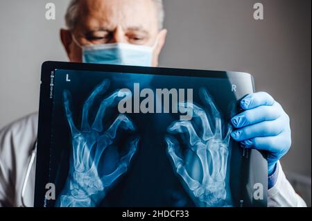 Medico che esamina una radiografia delle ossa delle mani di un paziente Foto Stock