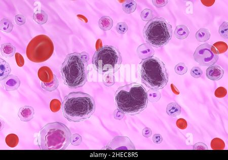 Cellule di linfoma non-hodgkin (NHL) nel flusso sanguigno - vista isometrica 3D illustrazione Foto Stock