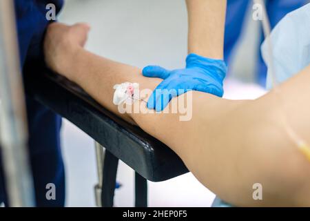 Ago contagocce in una vena sul braccio del paziente, adagiato sul tavolo operatorio. Messa a fuoco selettiva. Somministrazione endovenosa di farmaci attraverso un catetere. Foto Stock