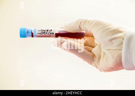 Omicron, variazione del virus corona. Provette per analisi del sangue per virus corona su sfondo bianco Foto Stock