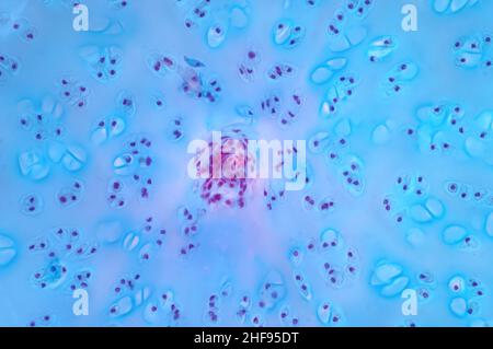 Osso cartilagine ialina umana, micrografia leggera Foto Stock