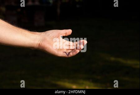 piccolo dito cucito dopo un'operazione Foto Stock