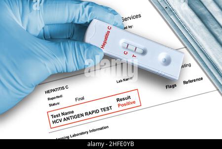 Risultato del test dell'antigene positivo dell'epatite C utilizzando un dispositivo di auto-test rapido tenuto a mano in un guanto medico con maschera medica in background. Foto Stock