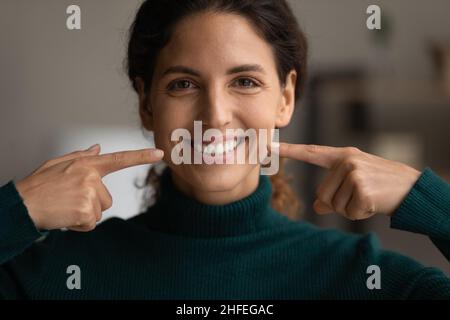 Primo piano sincero attraente giovane donna che punta al sorriso sano. Foto Stock