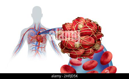 Malattia di embolia polmonare con un coagulo di sangue come una malattia con un blocco di un'arteria nei polmoni con 3D elementi di illustrazione. Foto Stock