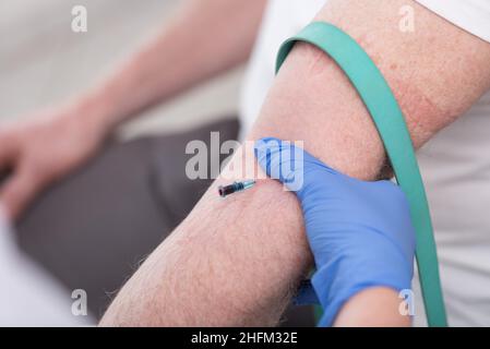 Catetere posizionato nella vena di un paziente Foto Stock