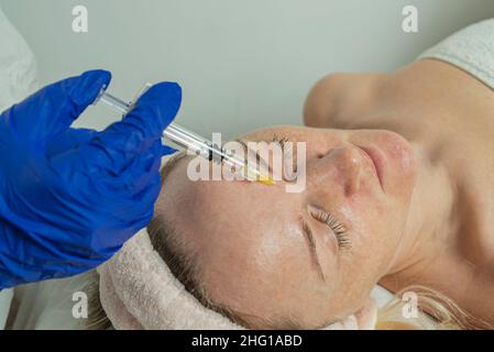 Primo piano di un'immagine ritagliata delle mani di un medico che fa la mesoterapia facciale su una bella donna Foto Stock