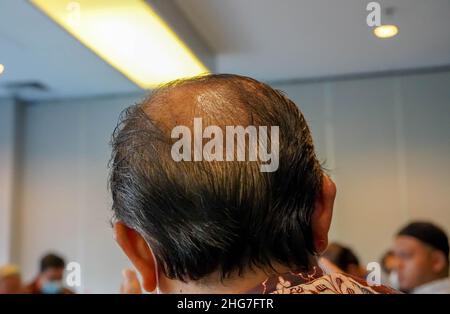 Uomo maturo, visto da dietro, nella testa, comincia a perdere i capelli, comincia ad essere vecchio. Foto Stock