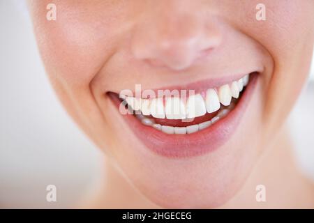 Sorridi un po'. Primo piano dei denti scintillanti di una donna. Foto Stock