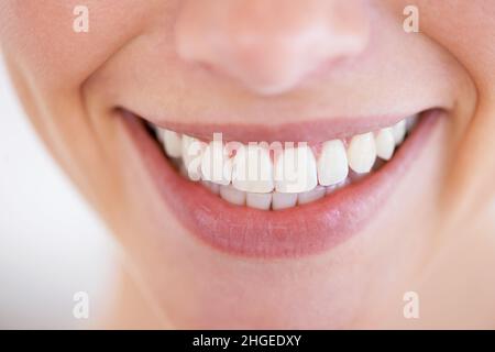 Sorriso abbagliante. Primo piano dei denti scintillanti di una donna. Foto Stock