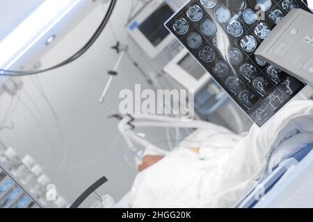 Paziente in compresenza sul ventilatore polmonare nell'unità di terapia intensiva. Foto Stock