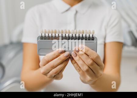 Il dentista dimostra la guida delle tonalità di colore dei denti per sbiancare i denti. Primo piano dei campioni di corrispondenza dei colori dei denti per impianti o impiallacciature nelle mani del medico. Foto di concetto sul tema dentale. Foto Stock