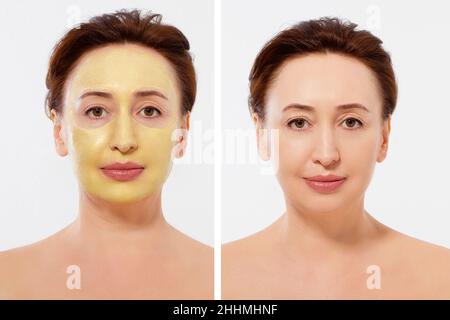 Medio età closeup viso donna prima dopo trattamento maschera di bellezza. Prima-dopo la pelle grinzosa. Estate anti invecchiamento maschera collagene su donna rughe viso è Foto Stock