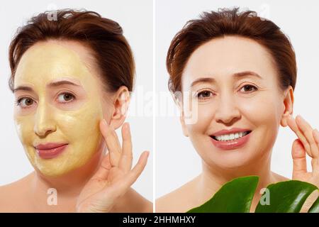 Medio età closeup viso donna prima dopo trattamento maschera di bellezza. Prima-dopo la pelle grinzosa. Estate anti invecchiamento maschera collagene su donna rughe viso è Foto Stock