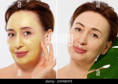 Medio età closeup viso donna prima dopo trattamento maschera di bellezza. Prima-dopo la pelle grinzosa. Estate anti invecchiamento maschera collagene su donna rughe viso è Foto Stock