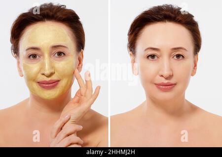 Medio età closeup viso donna prima dopo trattamento maschera di bellezza. Prima-dopo la pelle grinzosa. Estate anti invecchiamento maschera collagene su donna rughe viso è Foto Stock