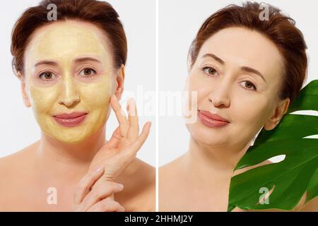 Medio età closeup viso donna prima dopo trattamento maschera di bellezza. Prima-dopo la pelle grinzosa. Estate anti invecchiamento maschera collagene su donna rughe viso è Foto Stock