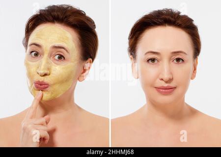 Medio età closeup viso donna prima dopo trattamento maschera di bellezza. Prima-dopo la pelle grinzosa. Estate anti invecchiamento maschera collagene su donna rughe viso è Foto Stock