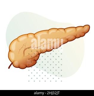 Pancreas - pancreatite acuta - Stock Illustration as EPS 10 file Illustrazione Vettoriale