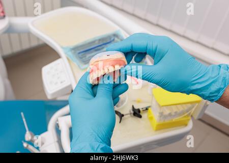 Protesi dentaria nelle mani del medico primo piano. Dentista che tiene ponte dentistico in ceramica. Vista frontale della dentiera completa. Odontoiatria concettuale Foto Stock