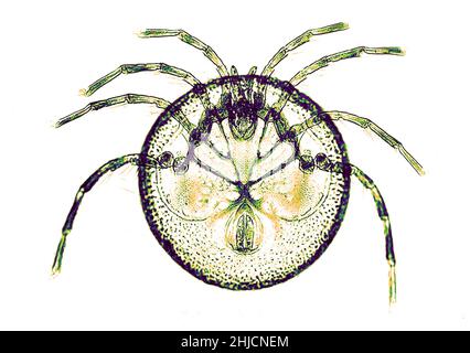 Mideopsis orbicularis, un acaro. Ingrandimento: 64x. Fotomicrografia realizzata da Arthur e Smith all'inizio del 1900s, utilizzando un microscopio e una fotocamera combinati. Nel 1904, la Royal Society di Londra ha esposto al pubblico una serie di fotomicrografie di Smith. In seguito sono stati pubblicati nel 1909 in un libro intitolato "Nature Through Microscope & Camera". Sono stati i primi esempi di fotomicroscopia che molti avevano mai visto. Foto Stock