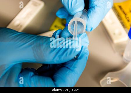 Test rapido COVID-19 eseguito in laboratorio ospedaliero con background di test virali Foto Stock