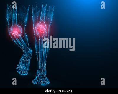 Illustrazione vettoriale poligonale delle gambe umane, delle ginocchia dolorose e infiammate. Concetto di ginocchio malato. Artrite delle articolazioni del ginocchio.. Banner medico, modello o Illustrazione Vettoriale