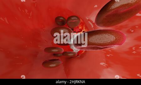 Emostasi. Globuli rossi e piastrine nel vaso sanguigno. Fasi di base del processo di guarigione delle ferite. illustrazione 3d Foto Stock