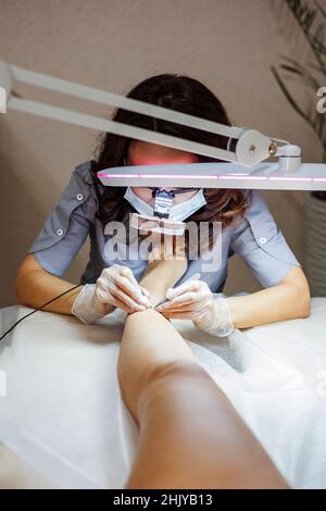 Il processo di rimozione permanente dei peli indesiderati sulle gambe utilizzando un dispositivo di elettroepilazione e pinzette. Foto Stock