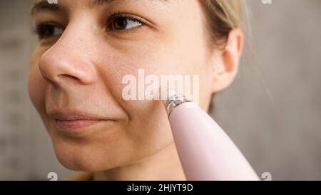 Dispositivo di aspirazione per la rimozione di teste nere e pimples dal viso. Dispositivo di massaggio automatico. Home concetto di cosmetologia. Foto ravvicinata della guancia Foto Stock