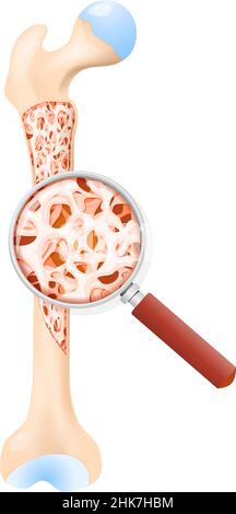 densità di un osso sano. Sezione trasversale del femore umano. All'interno di un osso che mostra la struttura trabecolare. Primo piano del tessuto osseo. Illustrazione Vettoriale