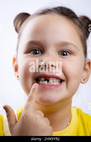 Aprire la bocca del bambino con la macro del dente mancante. Medico dentista  controllare lo stato dei denti. Con apribottiglie in studio dentistico Foto  stock - Alamy