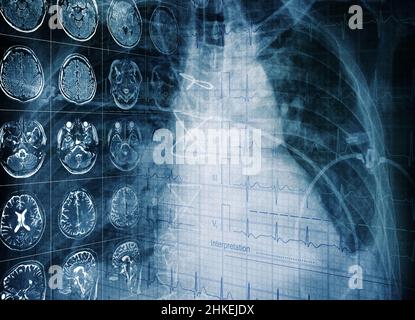 Concetto medico di esame di un paziente utilizzando le tecnologie moderne. Foto Stock
